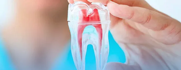 Endodontia: o que é e por que vale a pena se especializar?