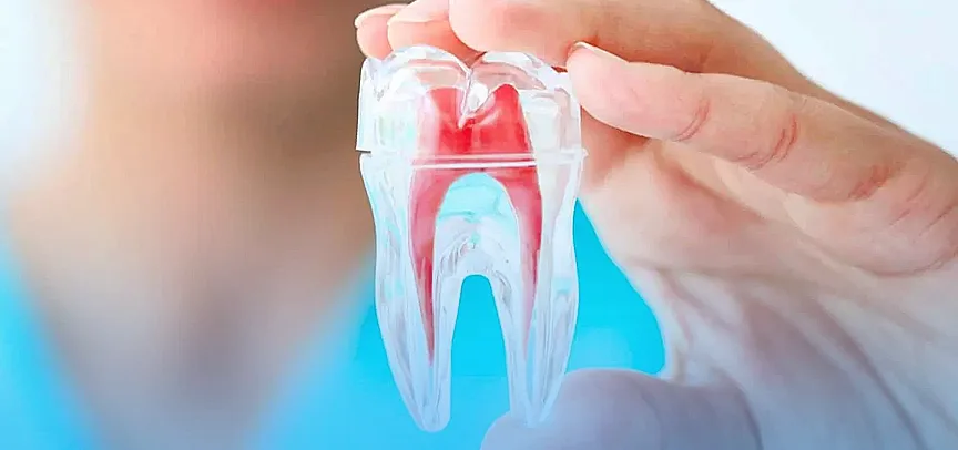 Endodontia: o que é e por que vale a pena se especializar?